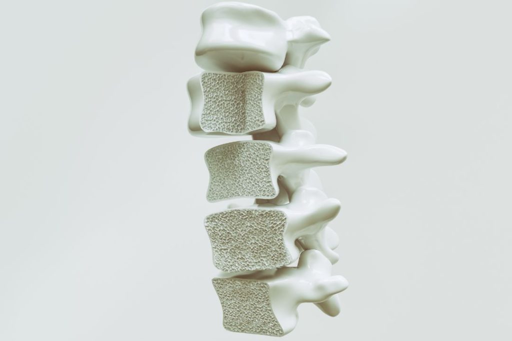 Todo lo que Necesitas Saber sobre la Osteoporosis, Causas, Síntomas y Tratamientos